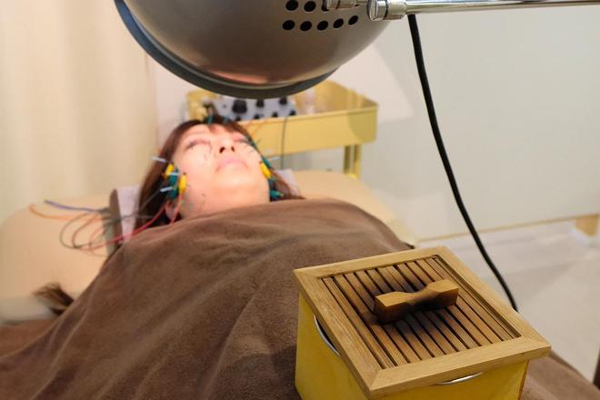 美容はり - 画像2