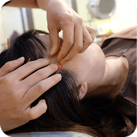 鍼での施術中の写真